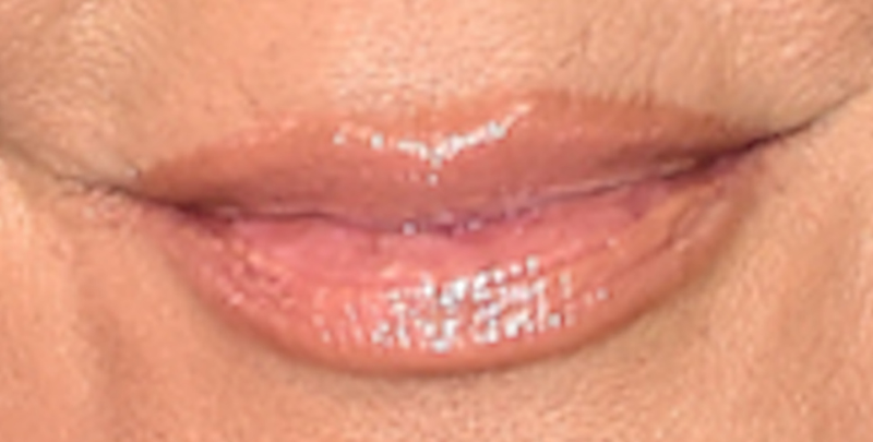Illustration for article titled Vicious Insects Attacked Kris Jenner's Lips But, Don't Freak, She's Fine